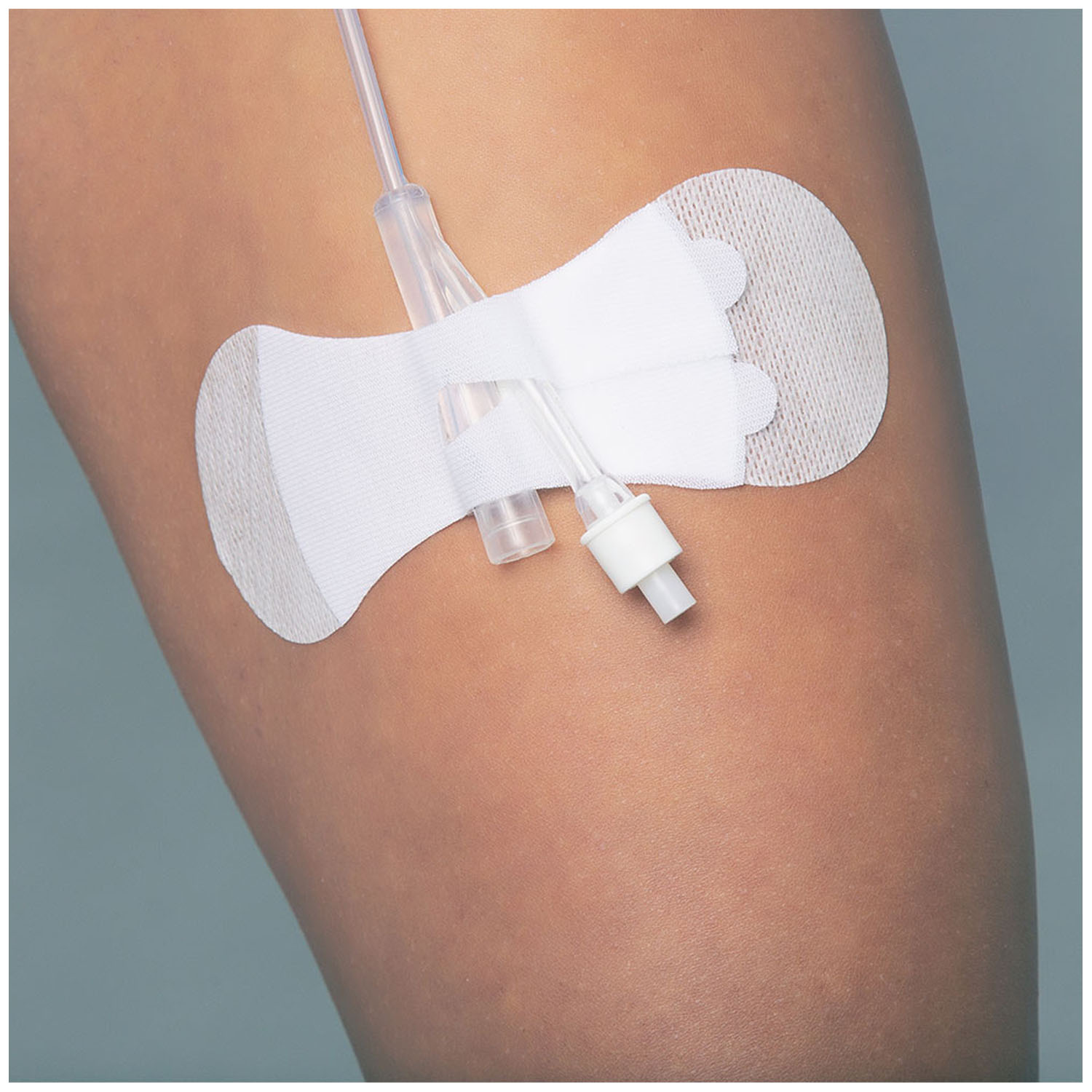 TIDI GRIP-LOK® FOLEY SECUREMENT DEVICE Securement Device, Universal, Foley, Large, Sterile, Individually Packaged, 100/bx TIDI Products, LLC 3400LFC